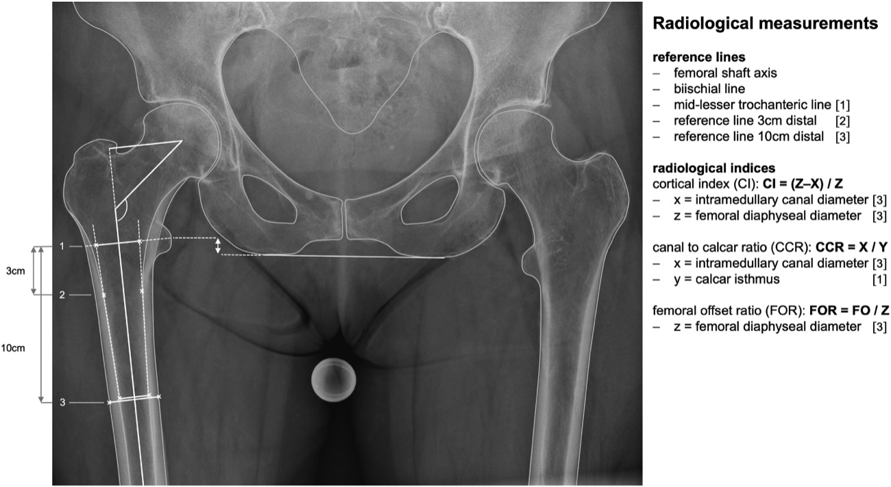 Radiological measurement technique